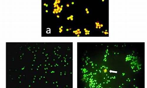 吖啶橙荧光染色观察细胞形态-吖啶橙染色法优缺点